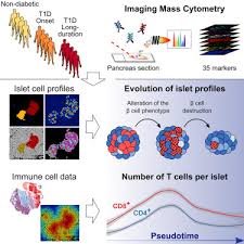 a map of human type 1 diabetes progression by imaging mass