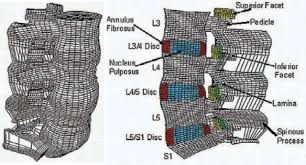 Anatomic Facet Replacement System Afrs Restoration Of Lumbar Segment Mechanics To Intact A Finite Element Study And In Vitro Cadaver Investigation International Journal Of Spine Surgery