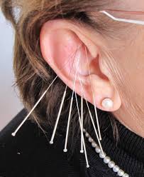 We did not find results for: Ohrakupunktur Auch Mit Dauernadeln Bei Hexenschuss Abnehmen Restless Legs