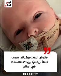 شخص الأطباء طفلاً بريطانيًا حديث الولادة بمرض وراثي نادر مميت، لدرجة أن  المرض ليس له اسم، ويبلغ الطفل من العمر 4 أسابيع، وبذلك يكون هذا الطفل واحد  من 23 طفلاً فقط حول