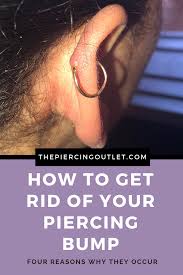 A keloid, which is a type of raised scar; How To Get Rid Of Piercing Bumps On Your Cartilage And Nose Piercings The Piercing Outlet