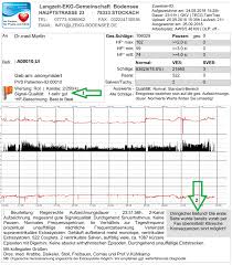 Befundvalidierung Langzeit Ekg Bodensee Langzeit Ekg Auswertung Fur Praxis Mvz Ambulanz Und Klinik