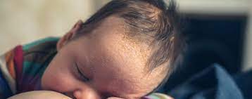 Auch in anderen teilen von nrw sind tote zu beklagen, etwa in kamen, solingen und geilenkirchen. Kopfgneis Beim Baby Erkennen Und Entfernen Kanyo