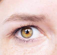 Czy leczenie zmarszczki nakątnęj u dziecka ma sens? Zmarszczka Nakatna U Niemowlat Party Pl