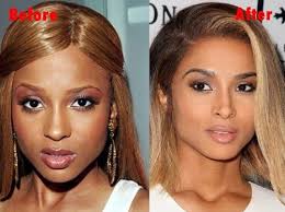 Pin On Plastic Surgery News