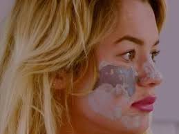 Tilly whitfeld was a housemate on big brother australia 13. Big Brother Star Tilly Whitfeld Reveals Scarred Face After Botched Tiktok Beauty Treatment News Com Au Australia S Leading News Site