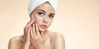 Kebanyakaan mereka rela mengeluarkan uang demi mendapatkan barang yang sedang populer supaya tidak ketinggalan tren. 7 Cara Menghilangkan Jerawat Saat Hamil