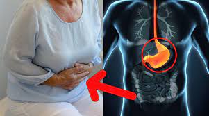 Symptôme cancer colon chez femme. 4 Symptomes Du Cancer De L Estomac A Ne Jamais Ignorer Une Pomme Par Jour