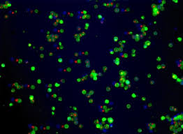 Maybe you would like to learn more about one of these? Apoptosis Necrosis Assay Kit Blue Green Red Ab176749 Abcam