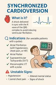 Image result for Synchronized Cardioversion