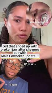 Gretta Johnson Broken Jaw