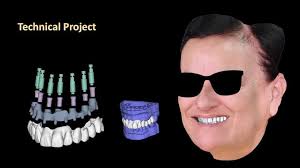 Advantages of shear shield operation