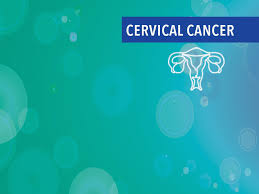 This is a very vague symptom not usually related to cervical cancer, mainly because many patients are used to having irregular menstruations. Treatment Of Stage Iv Cervical Cancer Cancerconnect