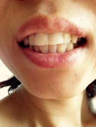 名無しのがるび 2021/05/27(木) 12:46:23.92 id:fw0hgp2qm.net >>99 å†™çœŸã‚ã‚Š å‡ºã£æ­¯ã‚'å‰Šã£ã¦å…¥ã‚ŒãŸä»®æ­¯ã®è¦‹ãŸç›®ãŒã²ã©ã„ä»•ä¸ŠãŒã‚Š æ­¯ãƒãƒ£ãƒ³ãƒãƒ«æ­¯ç§'ç›¸è«‡å®¤