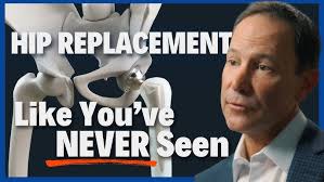 Hip Resurfacing Surgery by Robert Deveney MD