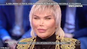 Jessica alves born in são paulo brazil nationality british main residence london 2nd residence marbella spain 3rd residence los angeles languages portuguese, spanish, english and french education ba in pr/coms i am outgoing, charismatic, and a truly passionate ambassador for the. Rodrigo Alves Reveals Nose Is Collapsing After 11th Rhinoplasty Daily Mail Online