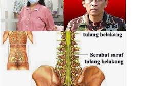 Sumsum tulang belakang merupakan salah satu bagian dari sistem saraf pusat manusia yang menghubungkan sistem saraf tepi dan sistem saraf pusat di otak. Ani Yudhoyono Akan Menerima Donor Sumsum Tulang Belakang Pramono Edhi Begini Keberhasilannya Bangka Pos