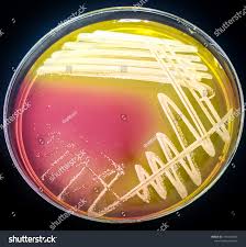 Image result for Staphylococcus Saprophyticus