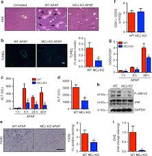 Isabel has 1 job listed on their profile. The Mitochondrial Negative Regulator Mcj Is A Therapeutic Target For Acetaminophen Induced Liver Injury Nature Communications