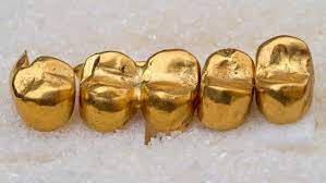 Maybe you would like to learn more about one of these? How Much Is Your Dental Gold Really Worth Komo