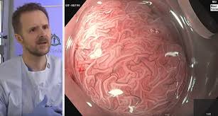 Avoid using a colon before a list if it directly follows a verb or preposition that would ordinarily need no punctuation in that sentence. Esd Colon Archive Endoscopy Campus