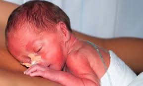 GUíAS CLíNICAS DERIVACIóN UNIDAD MATERNO FETAL