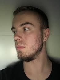 17 Years Old Should I Keep Growing This Out Or Is It Too Patchy The Moustache Is Only Around A Week Old The Beard Is Almost A Patchy Beard Beard Beard Rules