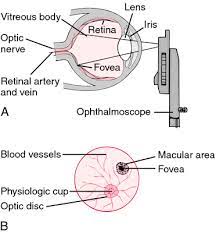 Your eye doctor can look through the lenses to examine your eye. Direct Ophthalmoscope Definition Of Direct Ophthalmoscope By Medical Dictionary