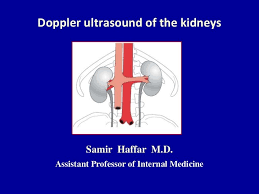 Doppler Ultrasound Of The Kidneys Ultrasound Vein Thrombosis Superior Mesenteric Artery Syndrome