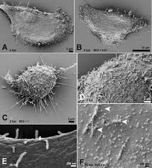 It also has a very high resolving power. Ultrastructural Analysis Of Sars Cov 2 Interactions With The Host Cell Via High Resolution Scanning Electron Microscopy Scientific Reports
