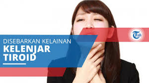Hipotiroidisme hipotiroidisme adalah kondisi ketika jumlah hormon tiroksin yang diproduksi oleh kelenjar tiroid terlalu sedikit. Penyakit Tiroid Gangguan Yang Disebabkan Oleh Kelainan Bentuk Atau Fungsi Kelenjar Tiroid Youtube