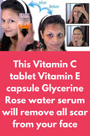 Suggested use as a dietary supplement mix one 1 scoop 15 g into 8 oz of water before, during or after exercise. This Vitamin C Tablet Vitamin E Capsule Glycerine Rose Water Serum Will Remove All Scar From Your Face To P Scar Removal Cream Scar Removal Diy Vitamin C Serum
