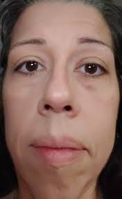 How to hide dark under eye circles and fix patchy foundation?