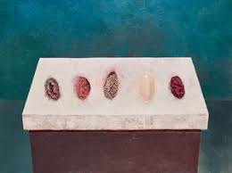 Subscribe to access price results for 150,000 artists! Penny Siopis Artist Profile Exhibitions Artworks Ocula