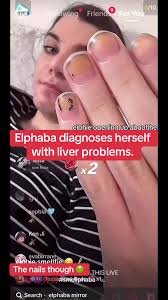 Liver Disease Nails