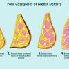 All women in england diagnosed early public health england is still nudging women to attend mammogram appointments. 1