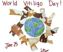We did not find results for: Barn Med Vitiligo I Norge Sverige Og Danmark Startseite Facebook