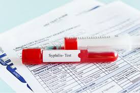 Syphilis (lues) die syphilis ist eine sexuell übertragbare erkrankung die durch bakterien (treponema pallidum) verursacht wird. Syphilis Test Wien Infos Adressen Auf Einen Blick Herold At