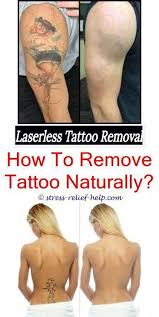 But how easy is it to get rid of your tat? Where Can You Remove A Tattoo Laser Tattoo Removal Hypopigmentation Tattoo Removal Hypopigmentati Tattoo Removal Laser Tattoo Tattoo Removal Cost