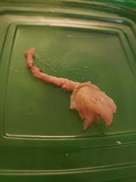 I was cooking ground beef and when I took it out of the pan, I noticed a strange object that didn't look like beef. Does anyone know what this is? Check the