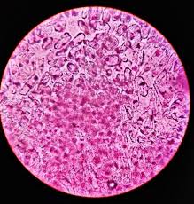 Maybe you would like to learn more about one of these? Stained Onion Root Tip Under Microscope 400x Biosensing Assay The Download Scientific Diagram