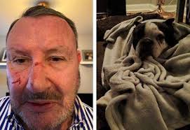 Pet owner says intervening in dog attack in Minster