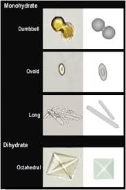 Your healthcare provider may also look at your lifestyle to help lower your risk factors or help find the cause of your. Lithiase Urinaires Oxalate De Calcium Analyse Urine
