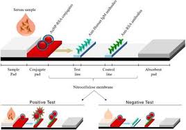 Includes detailed explanations, examples, and a link to download sample code. Frontiers Development Of A Gold Nanoparticle Based Lateral Flow Immunoassay For Pneumocystis Pneumonia Serological Diagnosis At Point Of Care Microbiology
