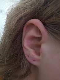 Does It Look Like I Have Enough Room For A Third Piercing On My Lobe If Not Is There Anything I Can Do Details In Comments Piercingadvice