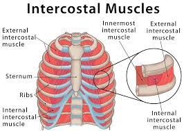 Musculoskeletal causes of rib cage pain and spasms. Intercostal Muscle Strain Orchard Health Clinic