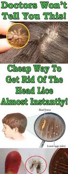 Doctors Won T Tell You This Cheap Way To Get Rid Of The Head Lice Almost Instantly Head Louse Head Lice Remedy Lice Remedies