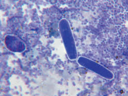 EEG for assessing the impact of febrile status epilepticus and predicting  outcomes