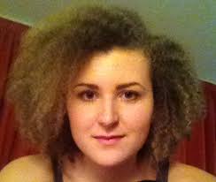 Give vital support to people on the run. Hair Issues Glasgowistheplacetobe