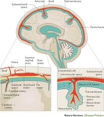 Learn about the brain disease called meningitis and find out what causes it. Community Acquired Bacterial Meningitis Nature Reviews Disease Primers